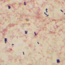 How listeria monocytogenes is transmitted. Listeria Monocytogenes Doccheck Flexikon