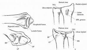 A transverse temporal bone fracture is shown in the image below. Distal Radius Fractures Trauma Orthobullets