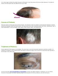 When your antioxidants are not adequate to retaliate the effects of free radicals, it leads to many health issues, including ageing. What Causes White Hair Patches And How It Is Treated
