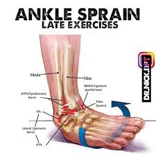 This is a mild sprain that damages the ligament but does not cause significant tearing. Late Phase Ankle Sprain Ankle Sprains Are An Extremely Common Occurrence They Can Vary From Relatively Min Sprained Ankle Sprain Ankle Rehab Exercises