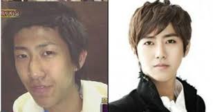 Ze A S Kwanghee Is Now A Plastic Surgery Spokesmodel Plastic Surgery Celebrity Plastic Surgery Celebs Without Makeup