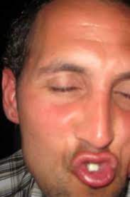 Alhough there is nowadays the possibility of lips. Duck Face Duckface