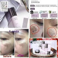 Extrak bunga edelweiss sangat terkenal sebagai agent pencerahan kerana dapat membantu halang melanin. Testimoni Lumivie Set Pudarkan Mary Kay Putrajaya Facebook