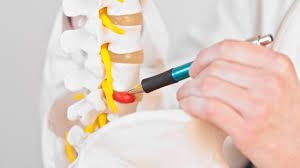 Slipped Herniated Disc Symptoms Causes And Effects Herniated Disc Herniated Disc Lower Back Herniated
