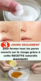 Vous Avez Besoin De 3 Jours Seulement Pour Fermer Tous Les Pores Ouverts Sur Le Visage Grace A Cette Recette Naturelle Magique Beauty Care Beauty Skin Remedies