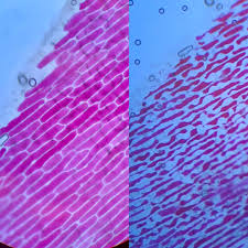 Maybe you would like to learn more about one of these? Red Onion Plant Cells Before And After Osmosis Taken Though A Regular Light Microscope Microfans