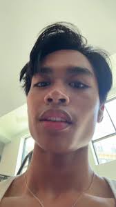 Angelo Marasigan Before After