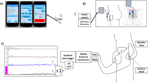 Unlimited mobile internet is a prepaid subscription service for internet on your mobile phones. Ambulatory Urodynamic Monitoring Assessment Of Dorsal Genital Nerve Stimulation For Suppression Of Involuntary Detrusor Contractions Following Spinal Cord Injury A Pilot Study Spinal Cord Series And Cases