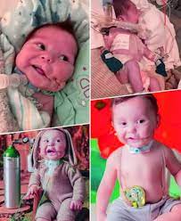 A tiny warrior with a smile brighter than any challenge. 🌟 ✨ Meet baby Elio — a little hero whose journey began with a rare medical challenge. Soon after birth, doctors discovered