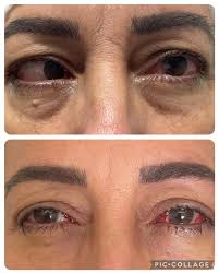 Dra.Karina Verdelho Leite (@dra.karina_verdelho_leite) • Instagram photos  and videos