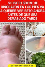 Pin En Remedios Caseros