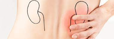 We did not find results for: Nierenschaden Durch Protonenpumpenhemmer Medical Tribune