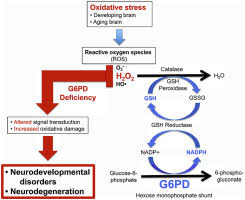 Image result for G6PD Deficiency