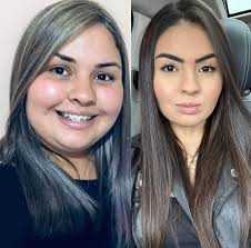 Nuevas Cápsulas 💊 💊 adelgazante con colágeno no deja la piel colgada 😍  baja hasta 24 libras en 30 días reduce cintura abdómen, espalda,  brazos,papada 100% Natural sin rebote, lo pueden tomar