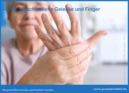 Geschwollene Dicke Finger Am Morgen