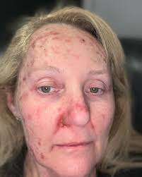 New Blog Post Alert Why we really need to listen to our bodies. Inspired by  how grateful I am for my body's amazing healing capacity even though I have  abused it so