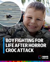 A seven-year-old boy was playing just a few feet from his parents when his  arm was ripped off. 💔 Full story: https://bit.ly/42ePwDf