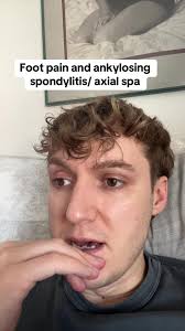 Massage for Ankylosing Spondylitis