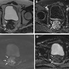 Elena Bracchi's research works