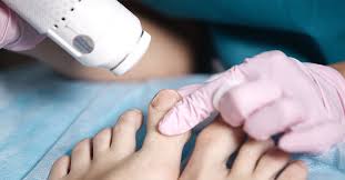 This happens if the blood vessels below your nail break and result in bleeding. Toenail Melanoma Or Fungus Diagnosis Causes And Treatment