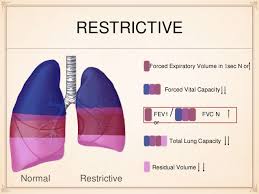 Obstructive Vs Restrictive Lung Disease