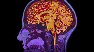 Mangofruitloops of even though it can at times be