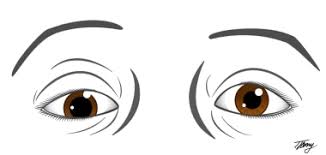 Image result for Pupillary Paralysis