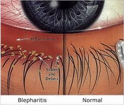 Image result for Blepharis bainesii