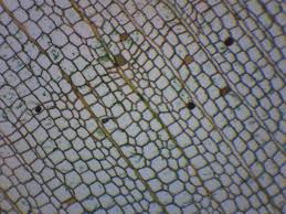 There are various cell organelles, out if which, some are common in most types of cells like cell membranes, nucleus, and cytoplasm. 25pk Cork Cells Cross Section Prepared Microscope Slides Classroom Pack 25 Slides In Storage Case Biology Microscopy Eisco Labs Amazon Com Industrial Scientific