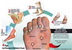 Pin On Healthy Tips