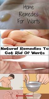 Home Remedies To Get Rid Of Warts Naturally Fast Permanently Health 360 Magazine Home Remedies For Warts Warts Remedy Get Rid Of Warts