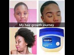 How To Grow Hair Fast Vaseline South African Youtuber Youtube Grow Hair Faster Grow Hair How To Grow Your Hair Faster