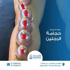 العلاج بالحجامة والرقية الشرعية Posts Facebook