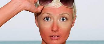 8 Ideas De Mascarilla Piel Quemada Como Aclarar La Piel Consejos Para La Piel