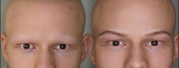 Medical tattooing treatments - YoankaPMU