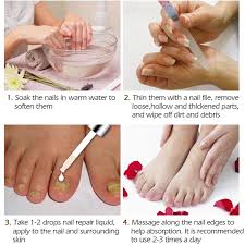 Maybe you would like to learn more about one of these? Suai Tratamiento De Hongos En Las Unas Esencia Para El Cuidado De Los Pies Gel De Eliminacion De Dedo Del Pie De Unas Antiinfeccion Paroniquia Onicomicosi 20ml Utensilios Para Manicura