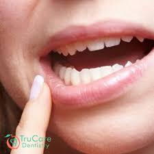 Easy way to pull out loose tooth with floss. How To Strengthen Loose Teeth Causes And Remedies Trucare Dentistry Roswell