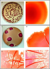 Volker brinkmann, max plank institute for infection biology, berlin. Frontiers Rugose Morphotype In Salmonella Typhimurium And Salmonella Heidelberg Induced By Sequential Exposure To Subinhibitory Sodium Hypochlorite Aids In Biofilm Tolerance To Lethal Sodium Hypochlorite On Polystyrene And Stainless Steel Surfaces
