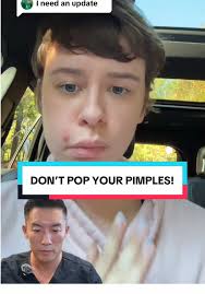 Daphne and Josh Acne