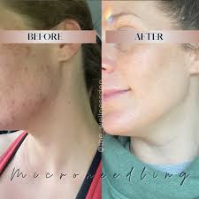 Dillon skin studio services available