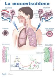 Au niveau des intestins, du pancréas et des bronches. La Mucoviscidose N Est Pas Une Maladie Contagieuse Association Les Amis De Constance