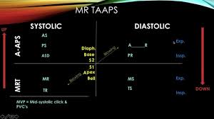 Heart Murmurs Made Easy Revised Now With Pediatric Chart And 35 Example Questions