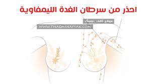 سرطان الغدة الليمفاوية تحت الإبط الأسباب والأعراض والعلاج ثقف نفسك
