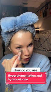 How to use hydroquinone ##moisturizer##hyperpigmentation##dermatology