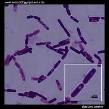 Bacillus cereus