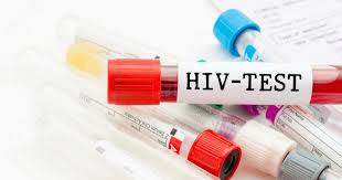 This is the first test you take to see if you have hiv. Cara Cara Untuk Membuat Ujian Saringan Hiv Bagi Tujuan Pernikahan