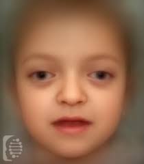 Maybe you would like to learn more about one of these? Sintomas Del Sindrome De Crouzon Caracteristicas Faciales Unicas