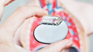 A case series and literature review. Implantable Cardioverter Defibrillator Heart And Stroke Foundation