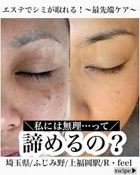 【ふじみ野 エステ】毛穴ニキビ跡肌質改善サロンR・feel