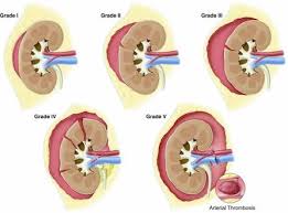 Image result for Genitourinary Trauma